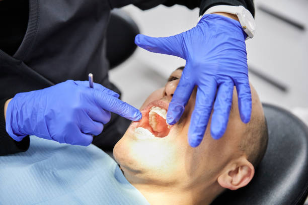 Best Emergency Tooth Extraction in Clayton, DE
